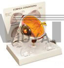 Eye Cornea Disease Anatomical Model Set